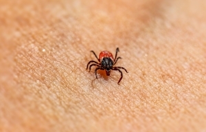 Eine schwarzrote Zecke auf der Haut eines Menschen.